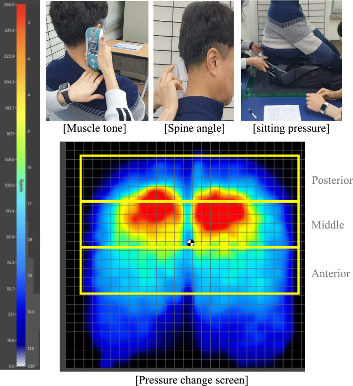 Effects of the lumbar support function of wearable robot (Bot Fit) on sitting position.