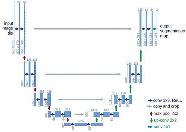 Segmentation with artificial intelligence and automated calculation of the corpus callosum index in multiple sclerosis.
