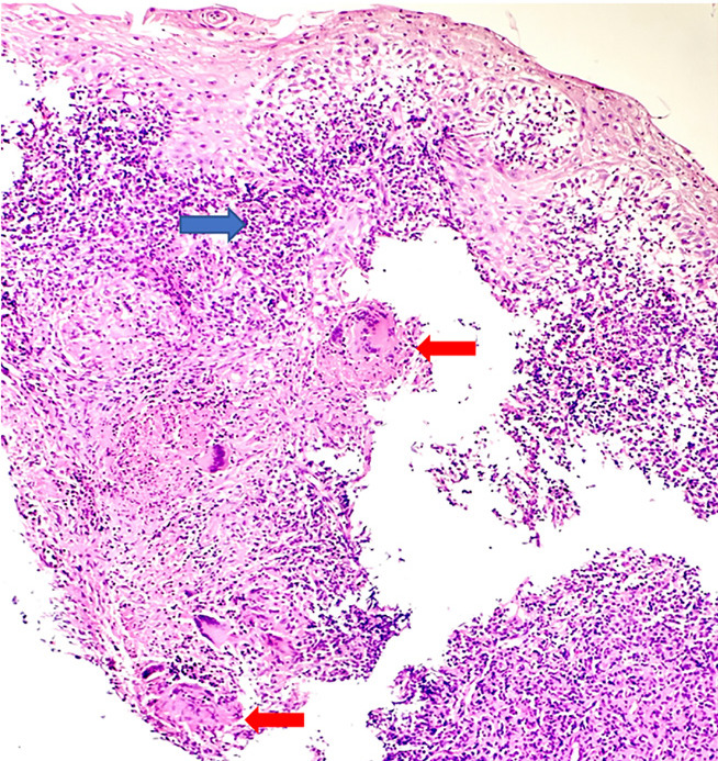 What is your diagnosis?
