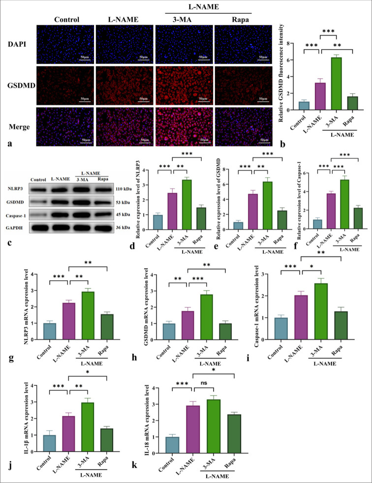 Mitochondrial autophagy inhibits nucleotide-binding oligomerization domain-like receptor protein 3-mediated pyroptosis and alleviates endothelial cell injury in pregnancy-induced hypertension.