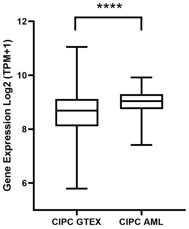 Evaluation of the Circadian Rhythm Component Cipc (Clock-Interacting Pacemaker) in Leukemogenesis: A Literature Review and Bioinformatics Approach.
