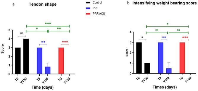 Clinical benefits of early-stage autologous conditioned serum and injectable platelet-rich fibrin on healing superficial digital flexor tendonitis in donkeys.