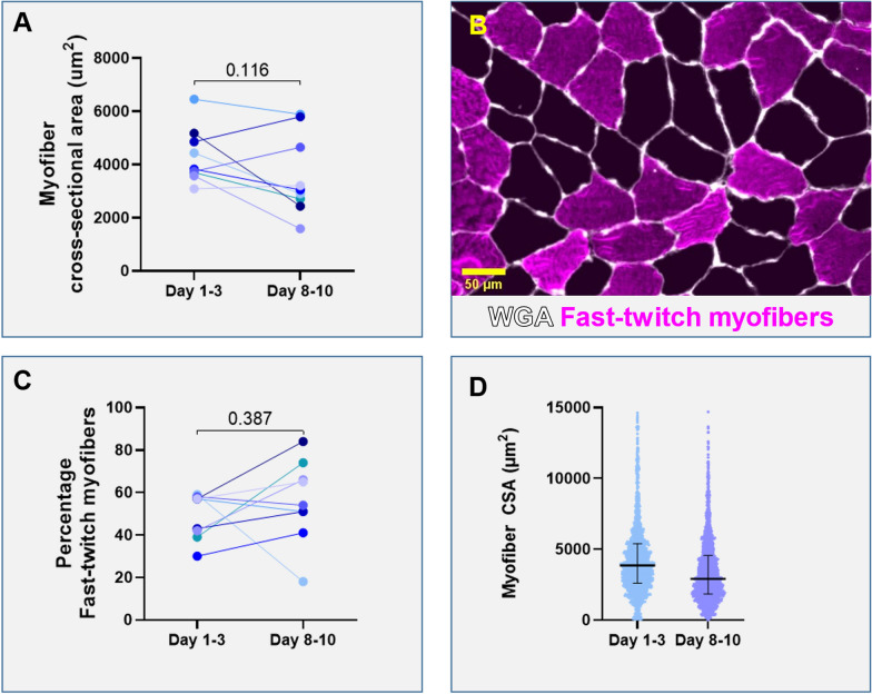 In vitro and in vivo muscle mass and strength during the first week of critical illness.