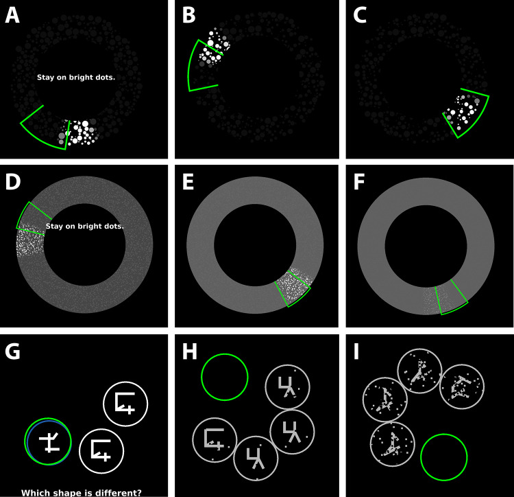 The Cognivue Amyloid Risk Measure (CARM): A Novel Method to Predict the Presence of Amyloid with Cognivue Clarity.