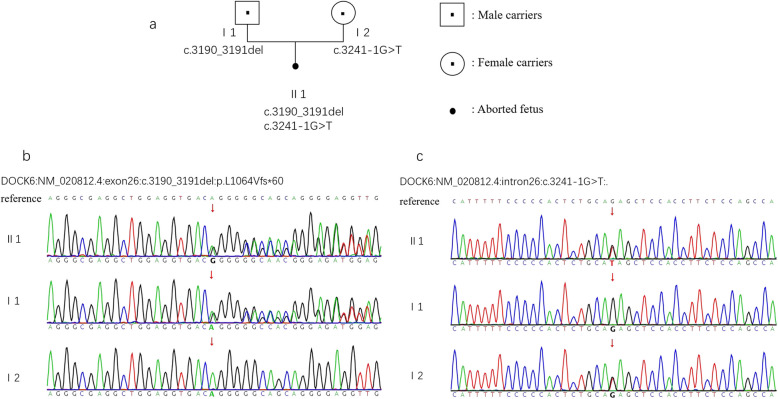 Novel compound heterozygous DOCK6 variants expand the mutational spectrum in prenatal diagnosis of Adams-Oliver syndrome 2.
