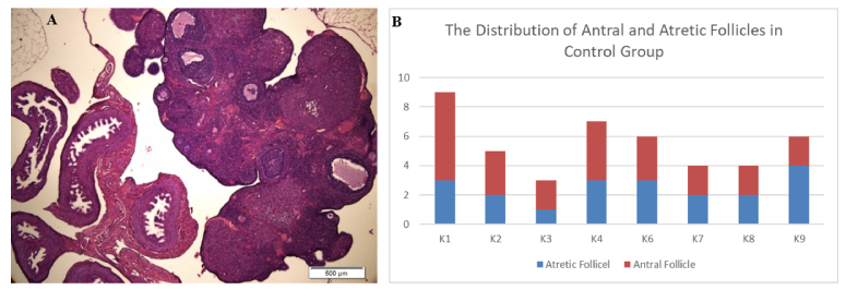 How does chronic unpredictable mild stress affect the number of mature oocytes? An experimental study.