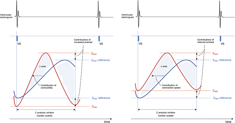 The clinical role of closed loop stimulation pacemakers in the treatment of patients with sinus node dysfunction: a review.