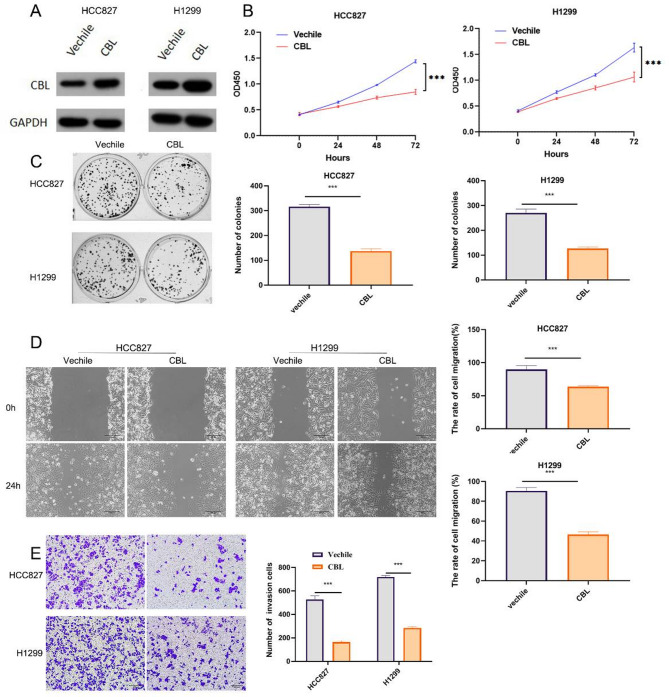 E3 ubiquitin-protein ligase CBL inhibits non-small cell lung cancer progression via ubiquitination and degradation of KDR.