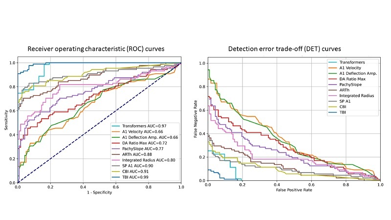 A Hybrid Transformers-based Convolutional Neural Network Model for Keratoconus Detection in Scheimpflug-based Dynamic Corneal Deformation Videos.