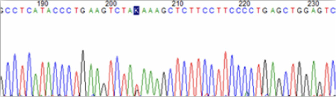 The Effect of GLUT-1-XbaI G>T and HaeIII T>C Polymorphisms on <sup>18</sup>F-FDG Uptake Rates.