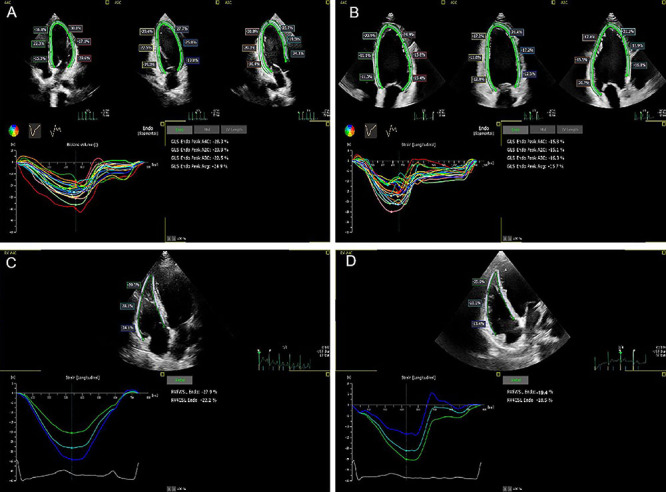 Prediction of early myocardial damage in obstructive sleep apnea patients using combined logistic regression and QUEST decision tree models.