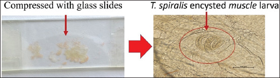 Viability of <i>Trichinella spiralis</i> in traditional sour pork fermentation and its inactivation by microwave heating: Implications for zoonotic risk and food safety.