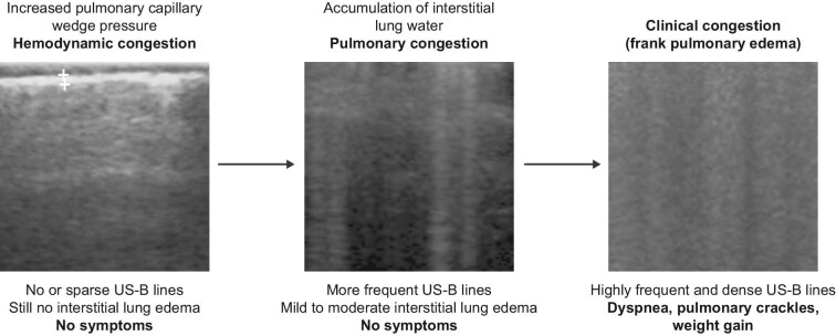 Decongestion in patients with advanced chronic kidney disease coexisting with heart failure.