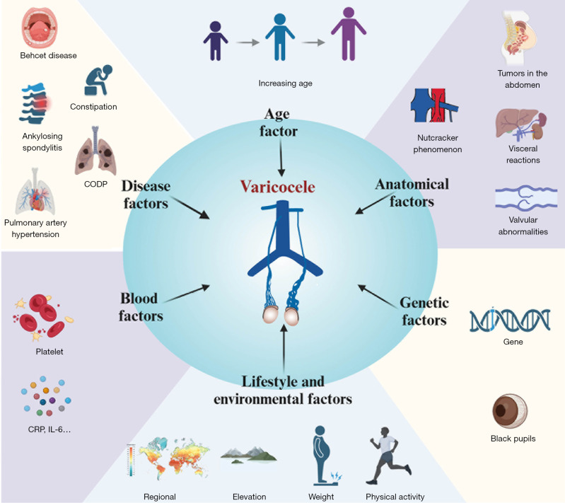 Risk factors associated with varicocele: a narrative review.