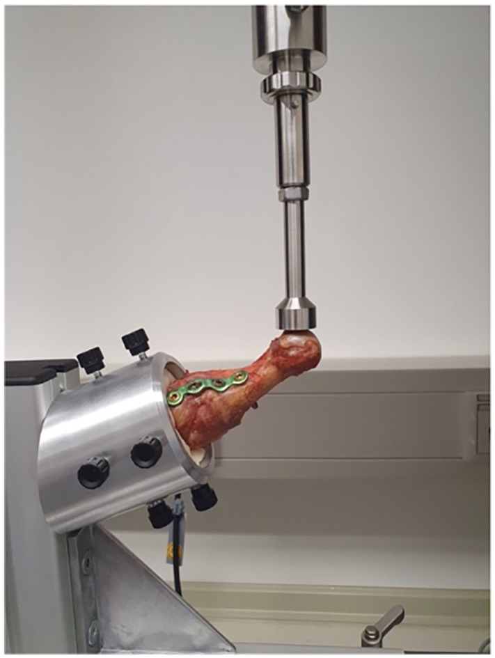 Biomechanical Comparison of Two Plantar Lapidus Plating Systems.