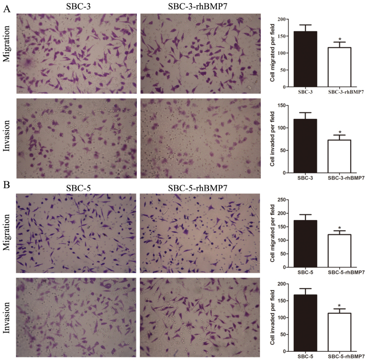 [Corrigendum] Biological effects of BMP7 on small‑cell lung cancer cells and its bone metastasis.