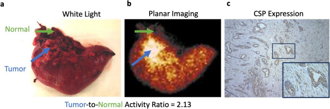 Imaging Cell Surface Plectin in PDAC Patients - A First-In-Human Phase 0 Study Report.