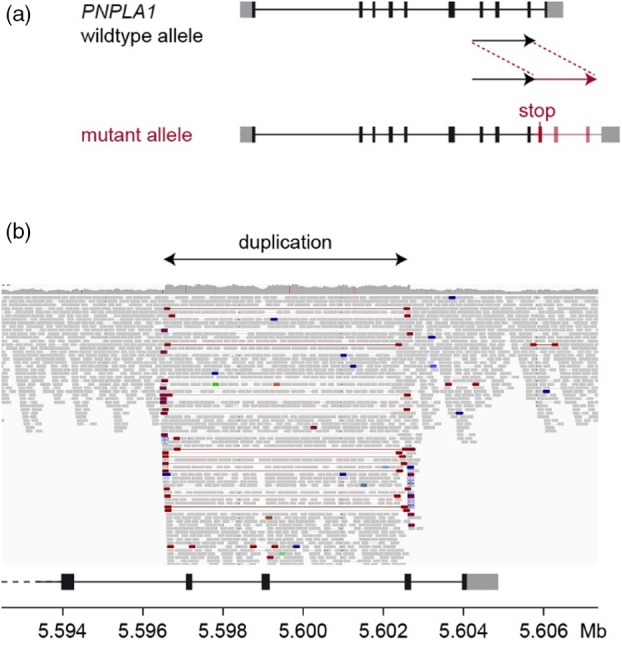 Intragenic PNPLA1 duplication in Labrador retrievers with nonepidermolytic ichthyosis.