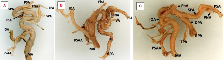 Anatomical basis of the elongated nasoseptal flap.