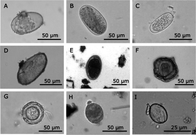 Study of parasitic fauna of three species of deer occurring in southeastern Mexico.
