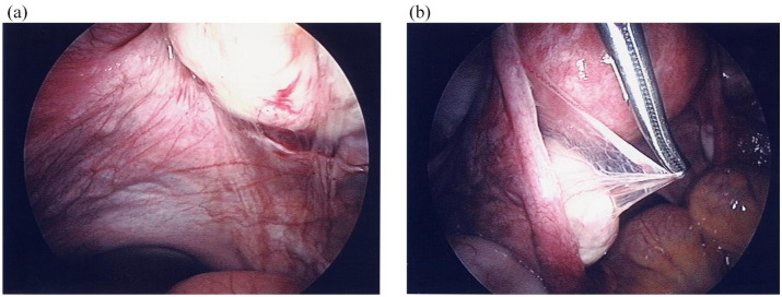 Revitalizing reproductive health: innovations and future frontiers in restorative medicine.