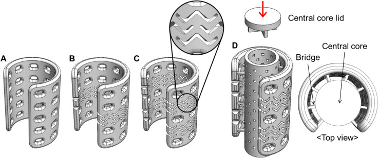 Feasibility Assessment of 3D Printing-Based Tubular Tissue Flap in a Porcine Model for Long Segmental Tracheal Reconstruction.
