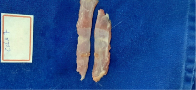 The use of surgical glue and sutures in the aponeurosis synthesis of the abdominal wall in Wistar rats.