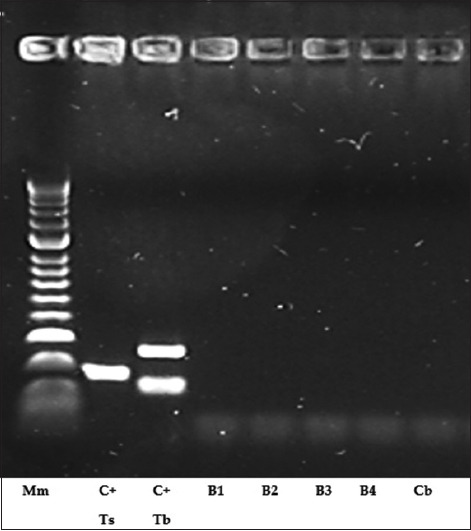 Controlled freezing inactivates <i>Trichinella britovi</i> in wild boar meat: Insights from a murine infection model and multiplex polymerase chain reaction.