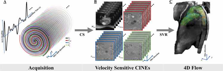 Rapid slice-to-volume four-dimensional flow in pediatric congenital heart disease: a feasibility study.