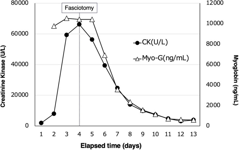 Systemic capillary leak syndrome complicated by lower extremity compartment syndrome: a case report.