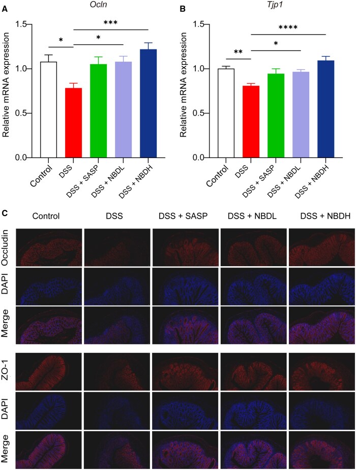 New Baitouweng Decoction alleviated DSS-induced colitis through the FXR/NLRP3 signaling pathway by regulating gut microbiota and bile acids.