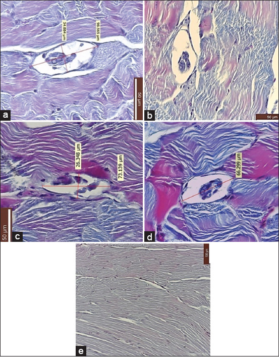 Controlled freezing inactivates <i>Trichinella britovi</i> in wild boar meat: Insights from a murine infection model and multiplex polymerase chain reaction.