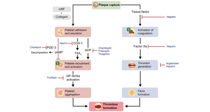 Effectiveness and Limitations of Intravenous rt-PA Therapy in Patients with Mild Cerebral Infarction.