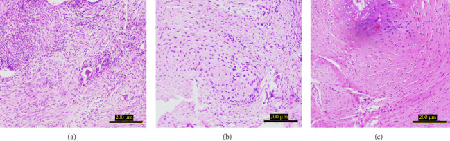 Evaluation of Radius Fracture Repair With Critical-Sized Bone Defects Using Polypropylene Surgical Mesh in Rats.