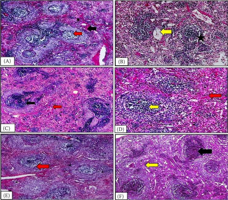 Antioxidant and cytokine modulation in PCOS rats protected with probiotics, myo-inositol, and herbal extracts.