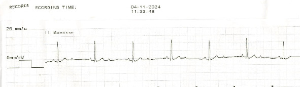 Sudden Cardiac Death due to Ventricular Fibrillation in a Dog Following Packed Red Blood Cell Transfusion.