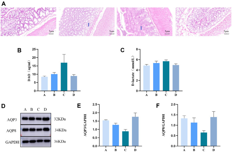 Modified Renshen Wumei Decoction Improves Qi-Yin Deficiency Diarrhea by Regulating the Gut Microbiotas and Metabolites in Rats.