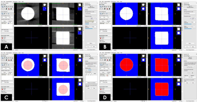 Position and variation in the number of high-density objects influence the expression of volumetric alteration artifacts in cone-beam computed tomographic images.