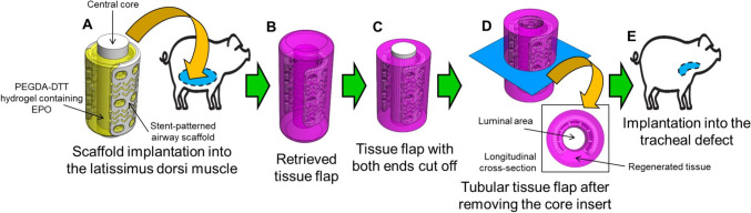 Feasibility Assessment of 3D Printing-Based Tubular Tissue Flap in a Porcine Model for Long Segmental Tracheal Reconstruction.