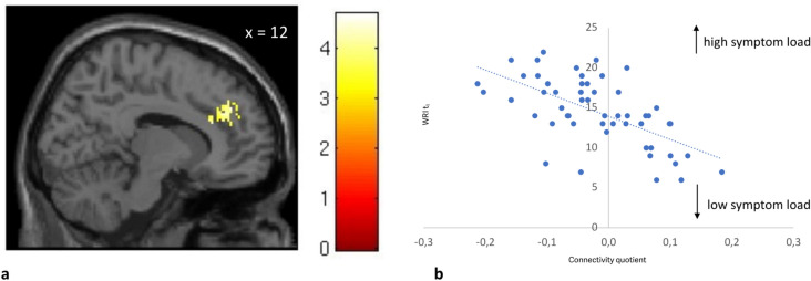 Functional connectivity of the nucleus accumbens predicts clinical course in medication adherent and non-adherent adult ADHD.