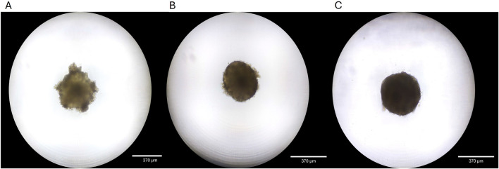 Bioengineering of novel organotypic 3D human liver tissue model for drug-induced liver injury and toxicity studies.