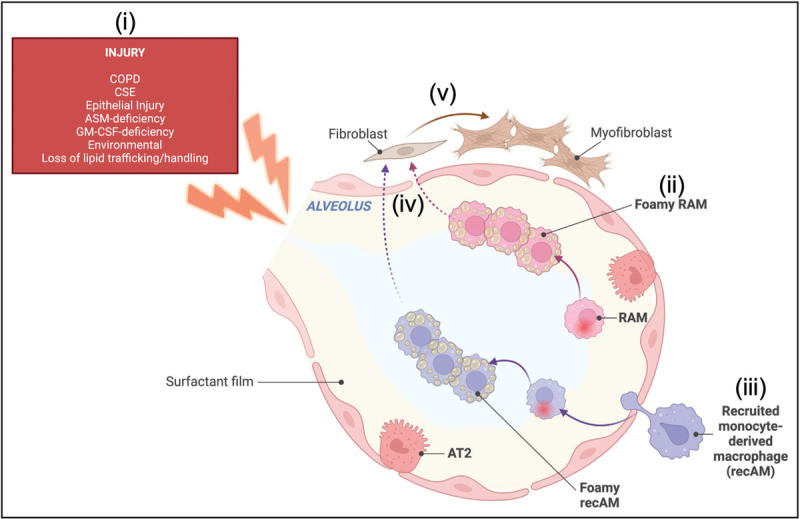 Alveolar macrophages: guardians of the alveolar lipid galaxy.