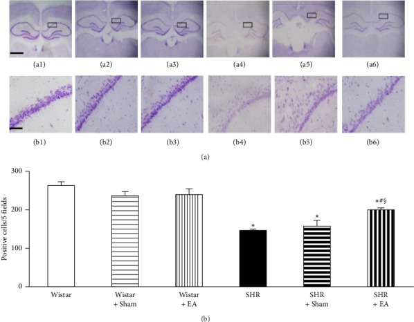 Corrigendum to "Long-Term Stimulation with Electroacupuncture at DU20 and ST36 Rescues Hippocampal Neuron Through Attenuating Cerebral Blood Flow in Spontaneously Hypertensive Rats".