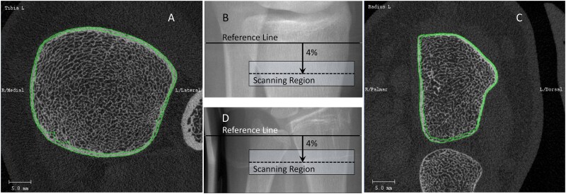 High-resolution peripheral quantitative computed tomography reliability and accuracy of bone density and morphology properties in children.