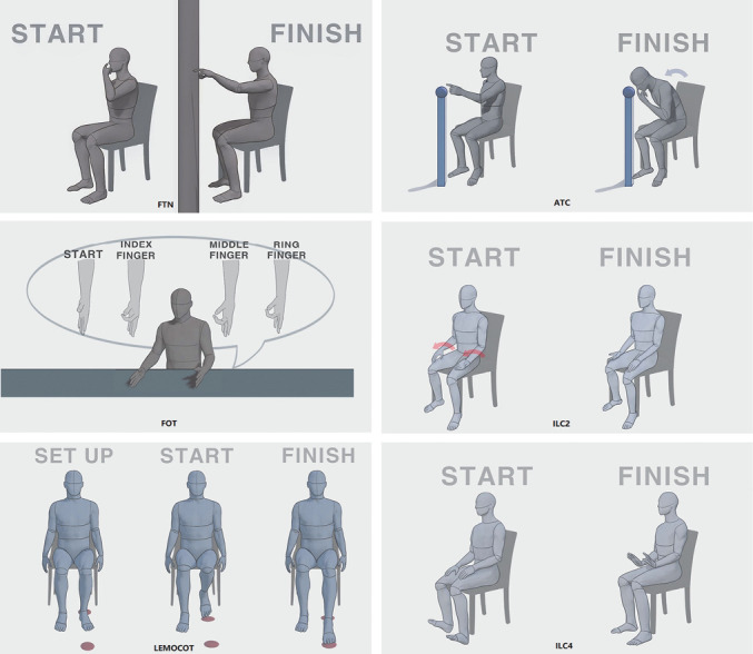 Psychometric validation of comprehensive coordination scale to assess the advanced coordination ability in people with stroke.