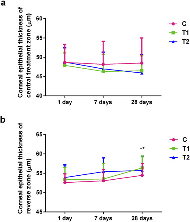 Changes in Corneal Epithelial Thickness and Higher-Order Aberrations Treated With a Newly Designed Orthokeratology Lens.