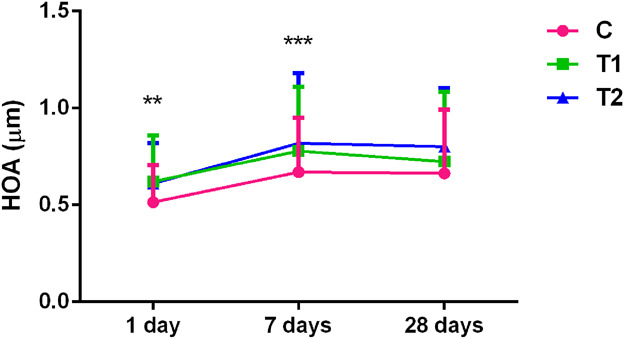 Changes in Corneal Epithelial Thickness and Higher-Order Aberrations Treated With a Newly Designed Orthokeratology Lens.