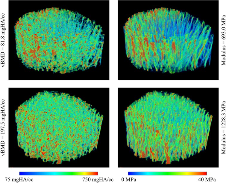 High-resolution peripheral quantitative computed tomography reliability and accuracy of bone density and morphology properties in children.