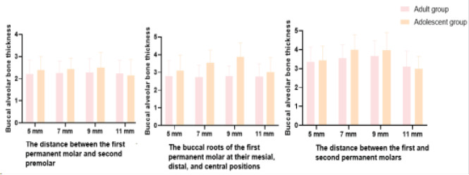 Alveolar ridge height changes in adults and adolescents with angle class I malocclusion before and after orthodontic treatment.