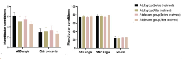 Alveolar ridge height changes in adults and adolescents with angle class I malocclusion before and after orthodontic treatment.